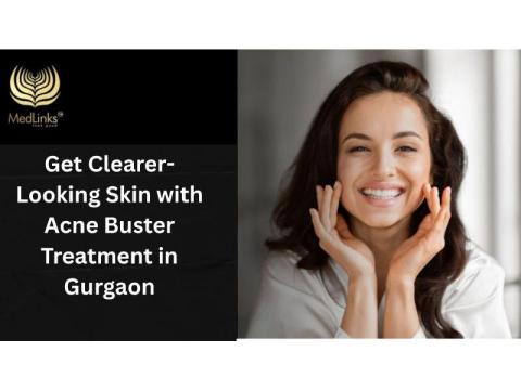 Clearer-Looking Skin Starts Here with Acne Buster in Gurgaon | MedLinks