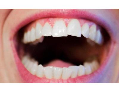 How Crowns Teeth Can Improve Your Smile and Oral Health