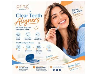 Clear Teeth Aligners in Tucson