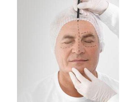 Rinoplastica in Italia