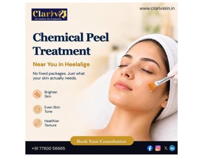 Chemical Peel Treatment in Heelalige – Near Me, Bangalore