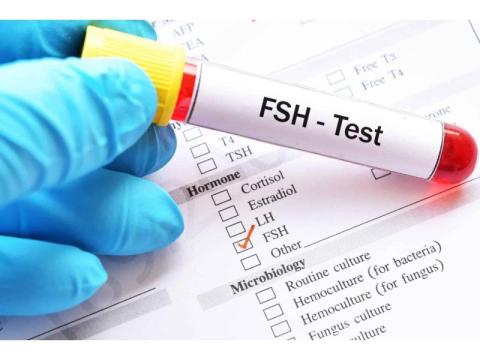 Follicle Hormone Test in Delhi | Accurate Diagnosis | Fertylity IVF