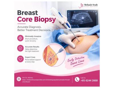 Ketahui Lebih Lanjut tentang Breast Core Biopsy di Singapura