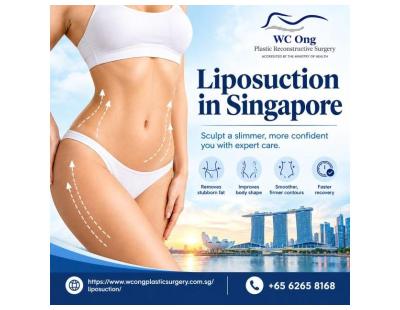 Book a Liposuction Consultation in Singapore – Refine Your Body Contour
