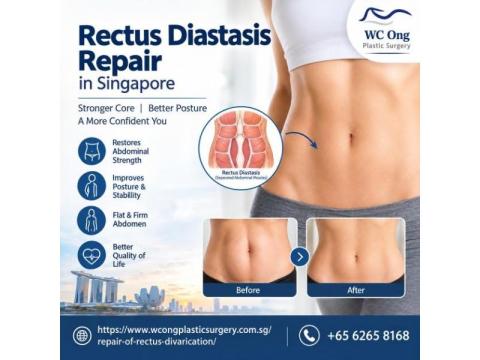 Book a Consultation for Rectus Diastasis Repair in Singapore