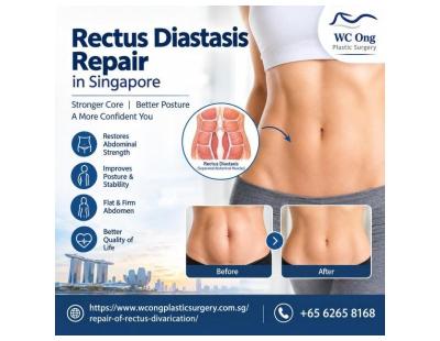 Book a Consultation for Rectus Diastasis Repair in Singapore