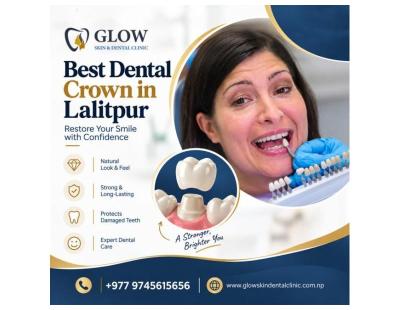 Best Dental Crown in Lalitpur for Restorative Dental Care