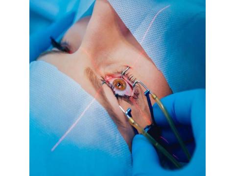 Experience Quality Care with the Best Laser Eye Treatment