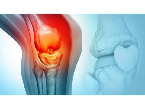 Personalized Bone Cancer Treatment in Noida | Dr Manish