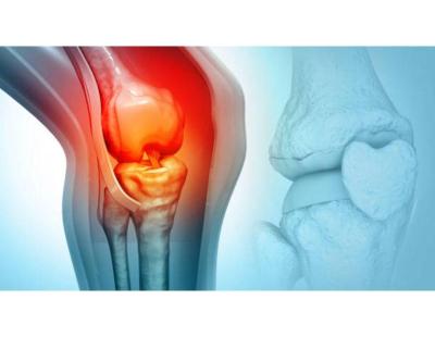 Personalized Bone Cancer Treatment in Noida | Dr Manish