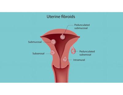 Best Uterine Evaluation in Delhi for Fertility Success | Fertylity IVF