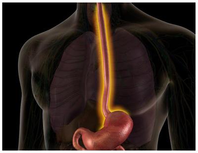 Personalized Esophageal Cancer Treatment in Noida Expert