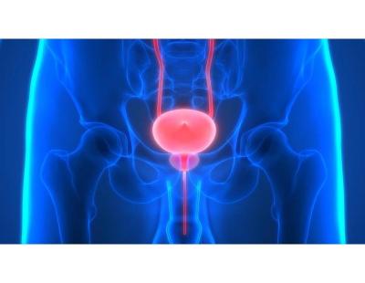 Hope & Healing Through Prostate Cancer Treatment in Noida