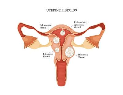 Detailed Uterine Evaluation in Delhi by Fertility Experts