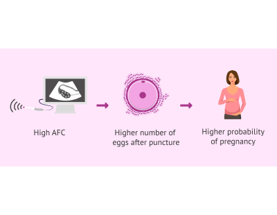 Accurate Ovarian Reserve Testing in Delhi | Fertylity IVF