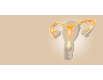 Accurate Hysterosalpingography in Delhi at Fertylity IVF