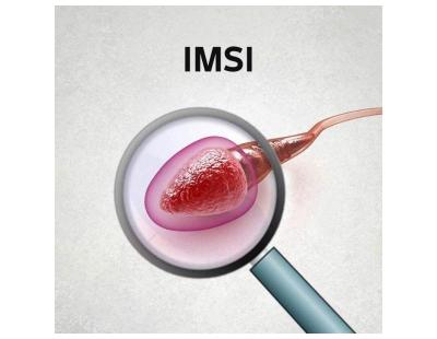 Advanced IMSI Treatment in Delhi for Male Fertility Care