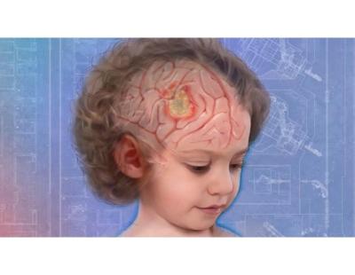 Quality Targeted Therapy Treatment in Noida | Dr. Manish Singhal