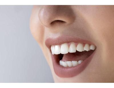 Tooth Color Fillings Auckland