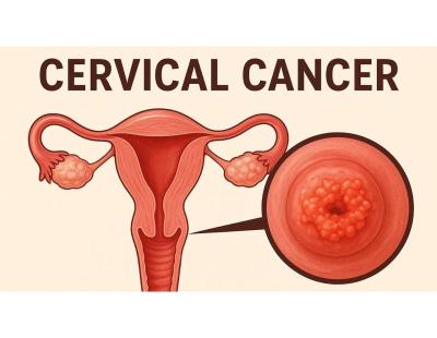 Advanced Cervical Cancer Treatment in Noida | Dr. Manish Singhal