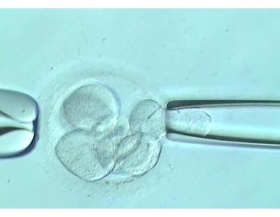 Discover Assisted Embryo Hatching in Delhi at Fertylity IVF
