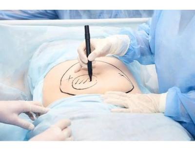 Colon & Rectal Surgery Services in Tuscaloosa, Alabama