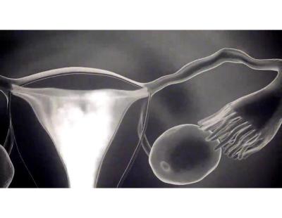 Female Infertility Treatment in Delhi with Expert Fertylity IVF Care