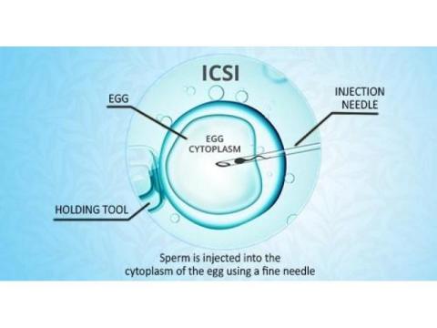 Modern ICSI Treatment in Delhi | Fertylity IVF Care