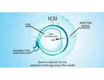 Modern ICSI Treatment in Delhi | Fertylity IVF Care