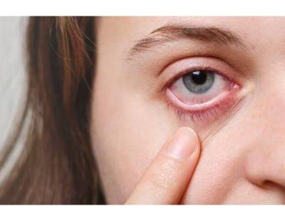 Advanced Dry Eye Treatment in Seattle, Washington State