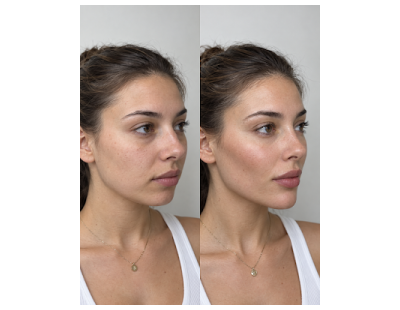 Aesthetic Clinic in Toronto for Personalized Skin Care