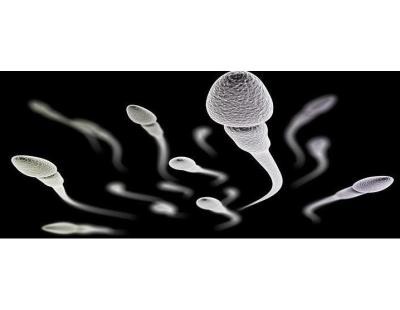 Percutaneous Epididymal Sperm Aspiration in Delhi | Fertylity IVF
