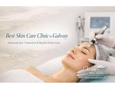 Advanced skin Treatments Galway