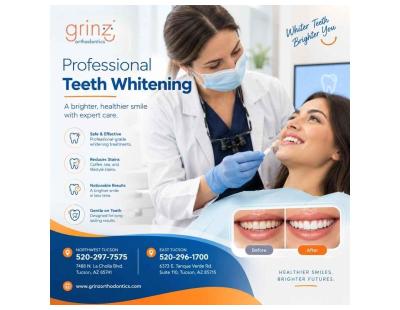 Teeth Whitening in Tucson