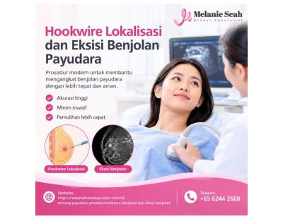 Mengenal Prosedur Hookwire Lokalisasi dan Eksisi Benjolan Payudara
