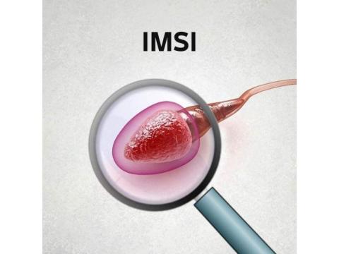 Trusted IMSI Treatment in Delhi | Fertylity IVF Clinic