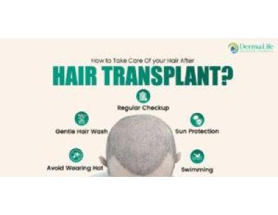 Hair Transplant Cost in Delhi: Price List & Graft Cost | Dermalife