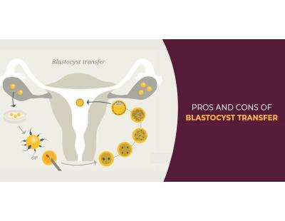 Blastocyst Transfer in Delhi | Fertylity IVF Expert Guidance