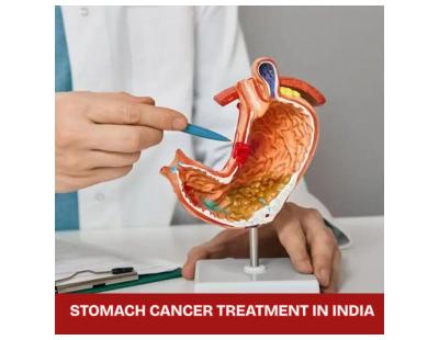 Cost of Stomach Cancer Treatment in India