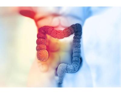 Colon Cancer Care & Treatment in Noida | Dr. Manish Singhal