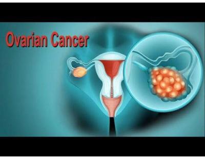 Ovarian Cancer Treatment Expert in Noida | Dr. Manish Singhal