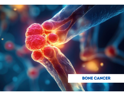 Quality Bone Cancer Treatment in Noida | Dr. Manish Singhal