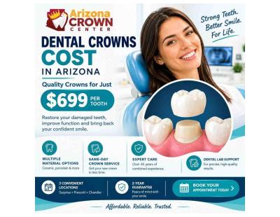 Dental Crowns Cost in Arizona – Quality Crowns for Just $699