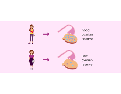 Ovarian Reserve Testing in Delhi for Better Fertility Insights