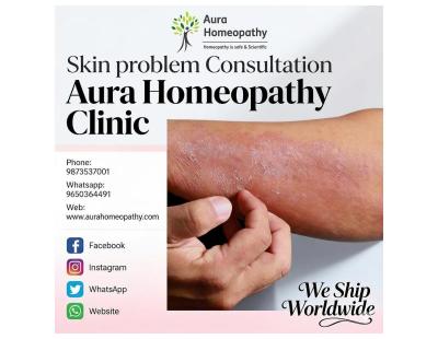 Psoriasis & Lichen Planus Consultation | Homeopathy in Faridabad