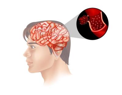 Quality Immunotherapy Treatment in Noida | Dr. Manish Singhal