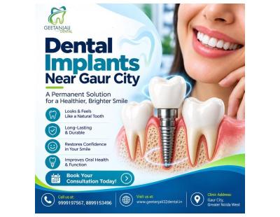 Dental Implants NEAR Gaur City for Missing Tooth Replacement
