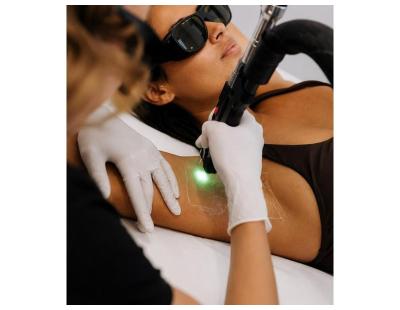 Laser Hair Removal in Toronto | Smoother Skin, Less Shaving