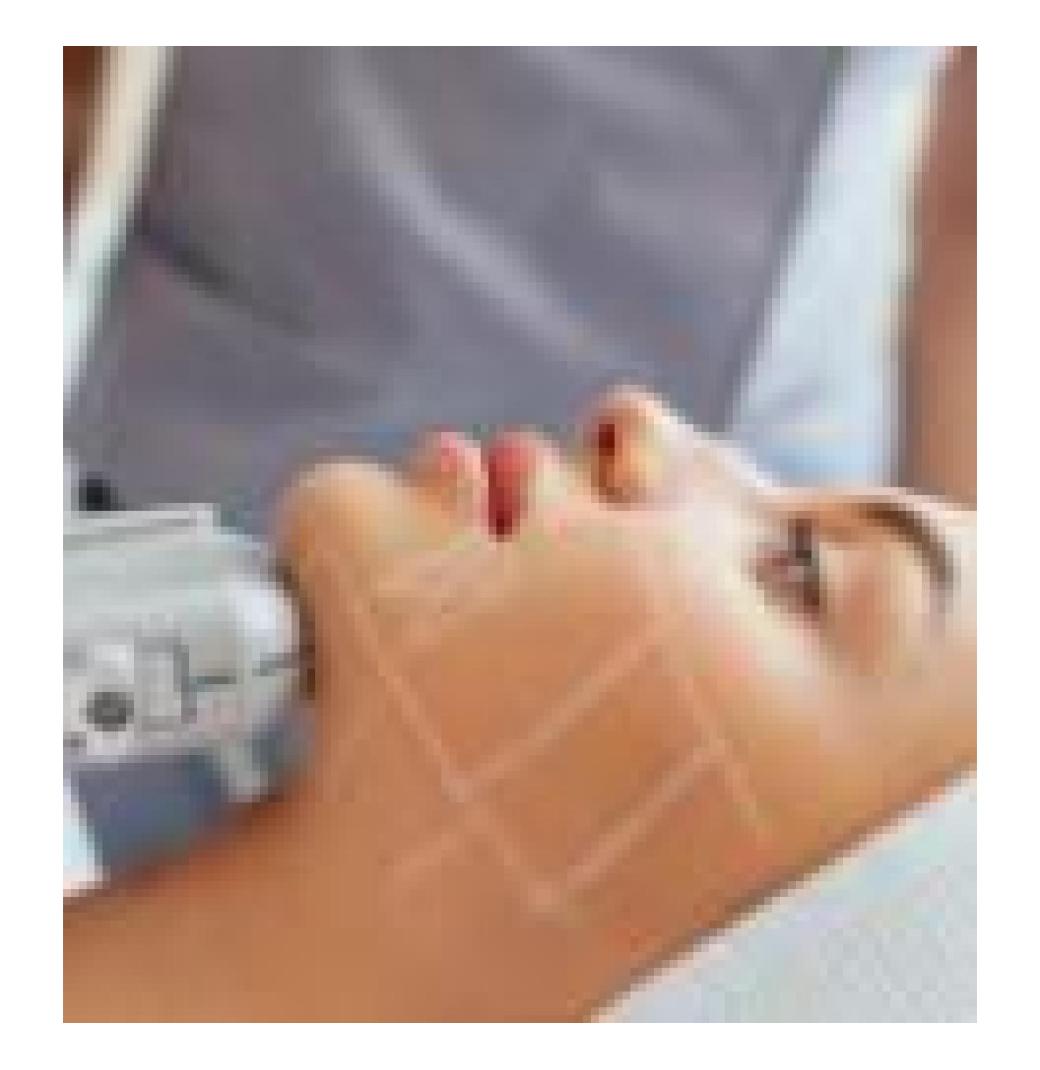Attiva Skin Tightening Castle Rock, CO