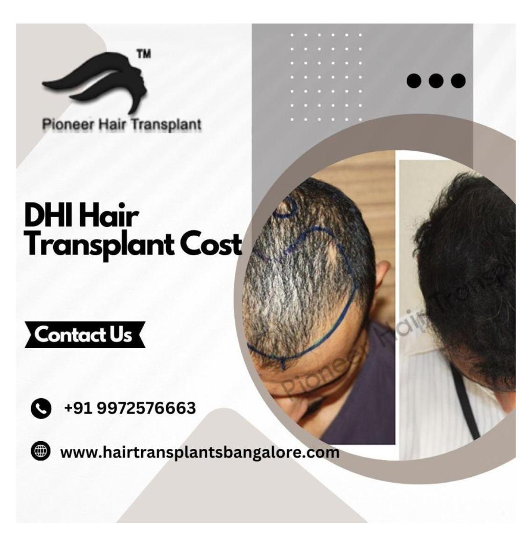 DHT Hair Transplant Bangalore | DHI Hair Transplant Cost - 1/3